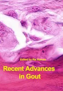 "Recent Advances in Gout" ed. by Rie Kurose