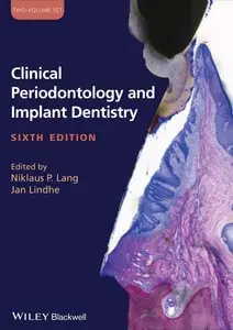 Clinical Periodontology and Implant Dentistry, 2 Volume Set, 6th Edition
