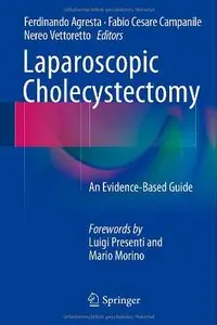 Laparoscopic Cholecystectomy: An Evidence-Based Guide 
