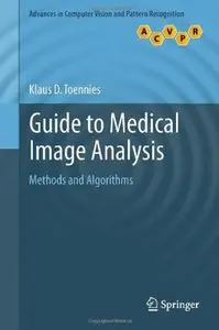 Guide to Medical Image Analysis: Methods and Algorithms [Repost]