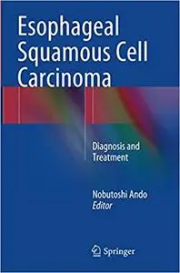 Esophageal Squamous Cell Carcinoma: Diagnosis and Treatment