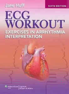 ECG Workout: Exercises in Arrhythmia Interpretation - Jane Huff (Repost)