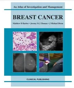 Breast Cancer: An Atlas of Investigation and Management