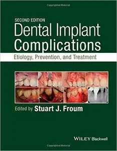 Dental Implant Complications: Etiology, Prevention, and Treatment, 2nd Edition (repost)