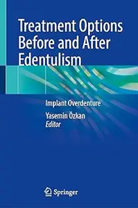 Treatment Options Before and After Edentulism: Implant Overdenture