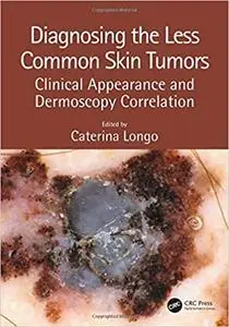 Diagnosing the Less Common Skin Tumors: Clinical Appearance and Dermoscopy Correlation