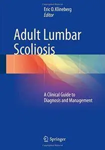 Adult Lumbar Scoliosis: A Clinical Guide to Diagnosis and Management [repost]