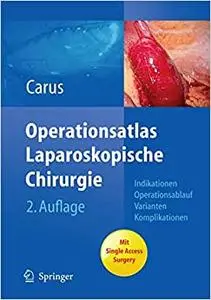 Operationsatlas Laparoskopische Chirurgie