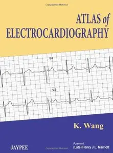 Atlas of Electrocardiography