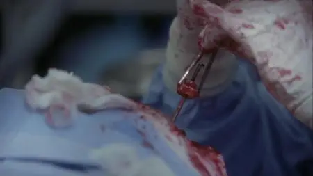 Grey's Anatomy S01E04