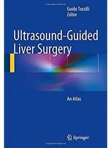 Ultrasound-Guided Liver Surgery: An Atlas [Repost]