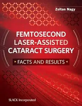 Femtosecond Laser-Assisted Cataract Surgery: Facts and Results