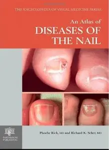 An Atlas of Diseases of the Nail [Repost]