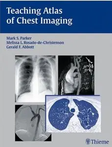 Teaching Atlas of Chest Imagin [Repost]