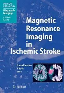 Magnetic Resonance Imaging in Ischemic Stroke (repost)