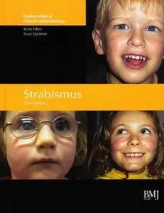 Strabismus: Fundamentals of Clinical Opthalmology by Frank Billson