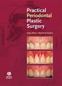 Practical Periodontal Plastic Surgery by Mamdouh Karima [Repost] 