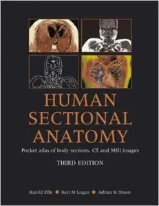 Human Sectional Anatomy: Pocket Atlas of Body Sections, CT and MRI Images, Third Edition (Repost)