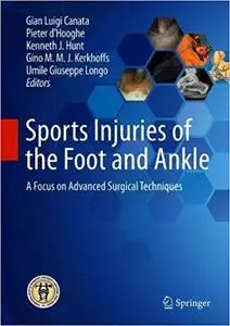 Sports Injuries of the Foot and Ankle: A Focus on Advanced Surgical Techniques