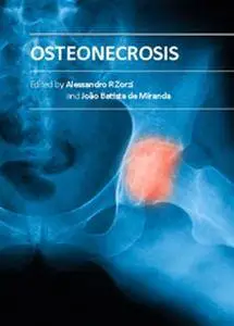 "Osteonecrosis" ed. by Alessandro R Zorzi and Joao Batista de Miranda