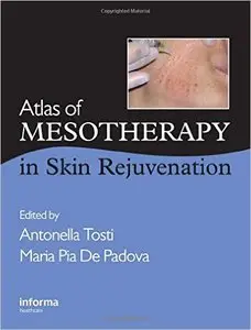 Atlas of Mesotherapy in Skin Rejuvenation by Antonella Tosti