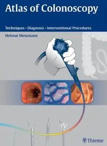 Atlas of Colonoscopy: Techniques - Diagnosis - Interventional Procedures [Repost]