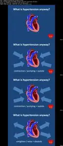 How to Reduce High Blood Pressure with Natural Medicine!