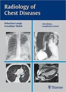 Radiology of Chest Diseases (3rd edition)