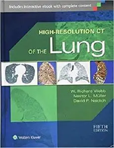 High-Resolution CT of the Lung [Repost]