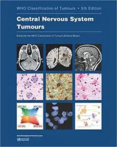 Central Nervous System Tumours: WHO Classification of Tumours Ed 5