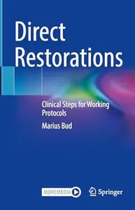 Direct Restorations: Clinical Steps for Working Protocols