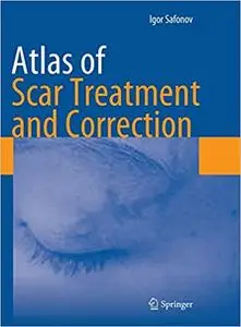 Atlas of Scar Treatment and Correction