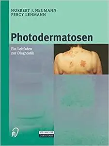 Photodermatosen: Ein Leitfaden zur Diagnostik