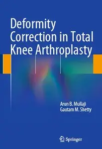 Deformity Correction in Total Knee Arthroplasty (repost)