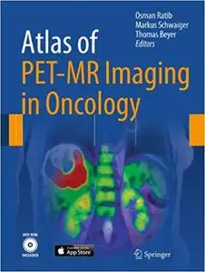 Atlas of PET/MR Imaging in Oncology