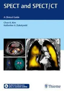 SPECT and SPECT/CT