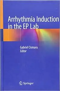 Arrhythmia Induction in the EP Lab