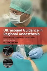 Ultrasound Guidance in Regional Anaesthesia: Principles and practical implementation, 2 edition