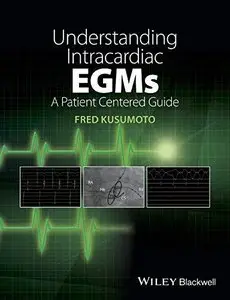 Understanding Intracardiac EGMs: A Patient Centered Guide