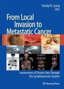 From Local Invasion to Metastatic Cancer: Involvement of Distant Sites Through the Lymphovascular System (Repost)