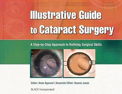 Illustrative Guide to Cataract Surgery: A Step-by-Step Approach to Refining Surgical Skills