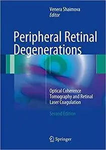 Peripheral Retinal Degenerations: Optical Coherence Tomography and Retinal Laser Coagulation, 2nd edition