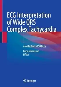 ECG Interpretation of Wide QRS Complex Tachycardia