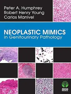 Neoplastic Mimics in Genitourinary Pathology