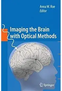 Imaging the Brain with Optical Methods