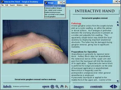 Interactive Hand Surgical