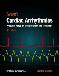 Bennett's Cardiac Arrhythmias: Practical Notes on Interpretation and Treatment (Repost)