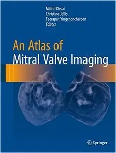 An Atlas of Mitral Valve Imaging (repost)