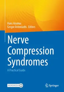 Nerve Compression Syndromes: A Practical Guide