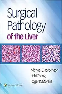 Surgical Pathology of the Liver